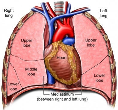 mediastinal-tumors